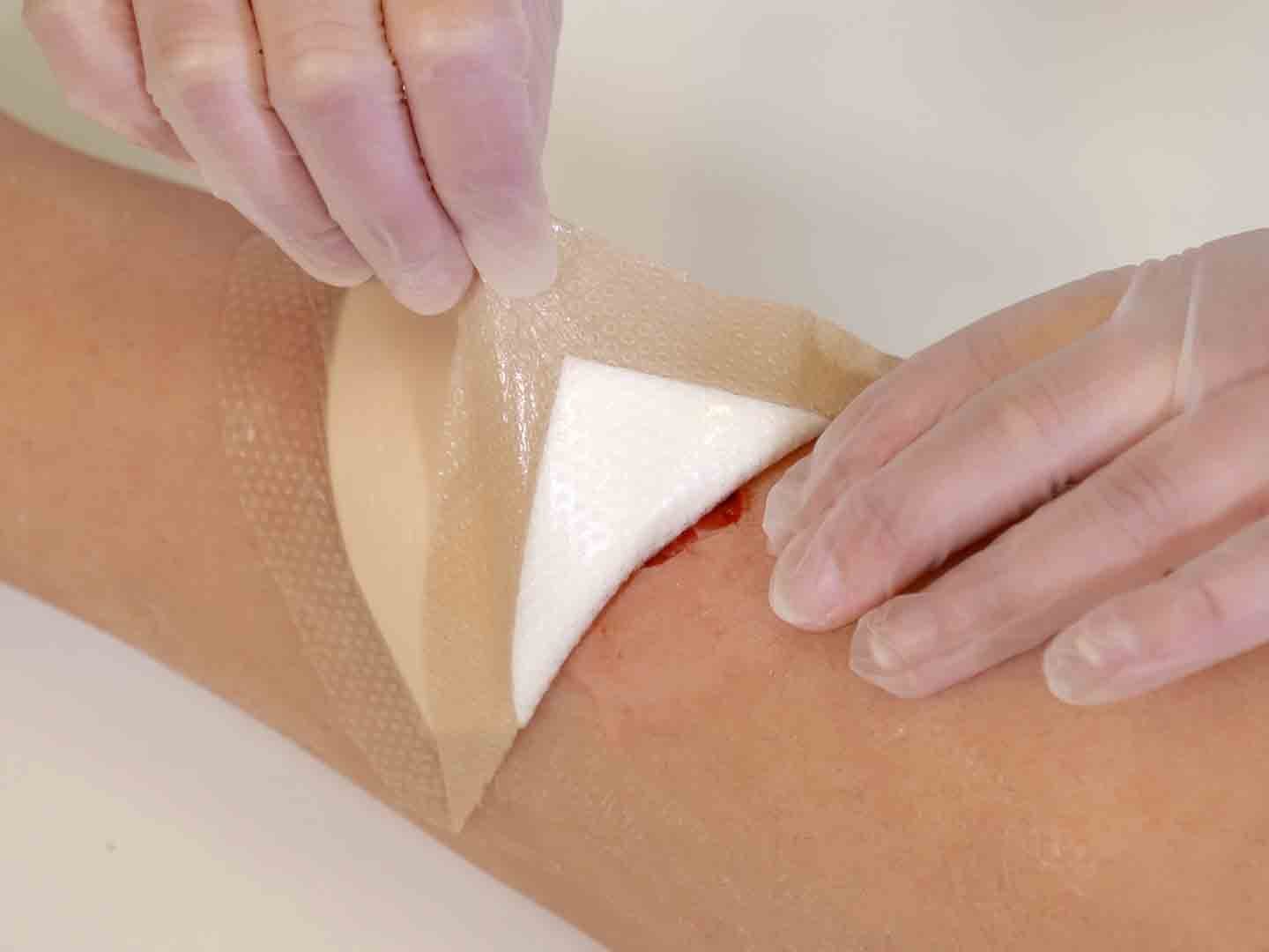 luofucon-advanced-foam-dressing-wound-care-dressing-buy-wound-care